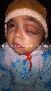 ⚠️ HERMANOS, sabemos que el grupo no va de esto pero de plano en esta si  necesitamos a la comunidad activa, Francis Guadalupe una niña que está  teniendo problemas de tumor tipo 1, el motivo de la ...