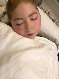 Dystonia Hero Aidan Fox