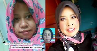 Iv) dinding tengah hidung senget. Menderita Kanser Hidung Selepas Berpantang Wanita Ini Share Bagaimana Dia Sembuh Walaupun Buta Nona