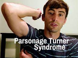 My Personal Experience Living With Parsonage Turner Syndrome Tony Florida