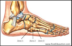 Image result for Metatarsal