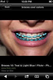 Black And White Braces Color Pin By Gabbi Rosas On Lips Braces Colors Cute Braces Braces Bands