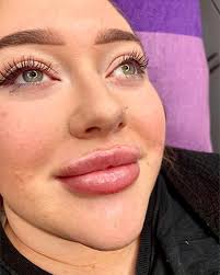 𝐀𝐄𝐒𝐓𝐇𝐄𝐓𝐈𝐂𝐒 𝐀𝐍𝐃 𝐁𝐄𝐀𝐔𝐓𝐘 𝐁𝐘 𝐂𝐀𝐒𝐒𝐈𝐄  (@cassie_aesthetics_) • Instagram photos and videos