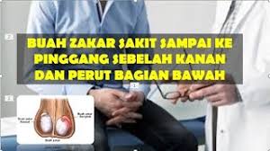 Penderita batu ginjal mungkin tidak akan merasakan sakit sampai batu ginjal mulai bergerak ke saluran yang menghubungkan ginjal dan kandung kemih. Buah Zakar Sakit Sampai Ke Pinggang Sebelah Kanan Dan Perut Bagian Bawah Youtube