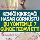 Kemik Panosundaki Pin