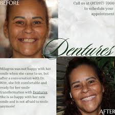 Check out Milagros' amazing smile transformation from Dentures, and watch  her testimonial