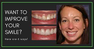 6 Ways To Improve Your Smile With Cosmetic Dentistry | Homestead Dental