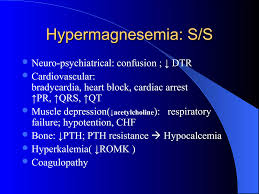 Image result for Hypermagnesemia