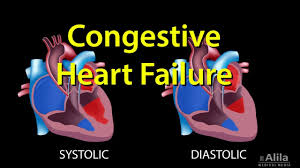 congestive heart failure left sided vs right sided systolic vs diastolic animation