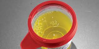 Six Things Your Pee Can Tell You Bicycling