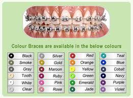 Black And White Braces Color Braces Color Chart Braces Colors Getting Braces Braces Tips
