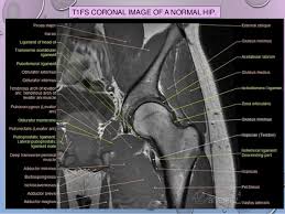 Check spelling or type a new query. Piriformis Muscle Mri Anatomy Shefalitayal