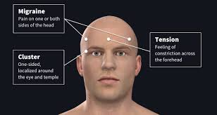 Everytime i brush or run my fingers through my hair i see big bunches of hair come out. The Facts About Headaches Complete Anatomy