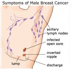 How to tell friends, family you have breast cancer. Did You Know That Men Can Also Get Breast Cancer Steemit