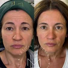 Estética Integrativa Letícia Meneses