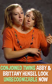 Despite the physical obstacles they've faced, these haven't prevented them from living fulfilling lives. Conjoined Twins Abby Brittany Hensel Look Unrecognizable Now Conjoined Twins Brittany The Incredibles