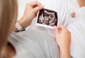 It's the best way to predict your during your dating scan your baby is carefully measured. 12 Weeks Pregnant Ultrasound What To Expect Mother Baby
