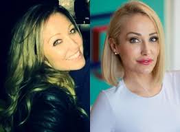 Have the Selling Sunset cast had cosmetic surgery?