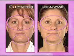 Maybe you would like to learn more about one of these? Derma Wand Dermawand