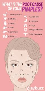 What Is The Root Cause Of Your Pimples In 2020 Skin Care Quiz Beauty Tips For Glowing Skin Beauty Skin Care Routine