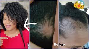 Pflegende conditioner von garnier lassen sich einfach auswaschen, ganz ohne zu beschweren. Homemade Deep Condition Treatment For Protein Sensitive Hair Low Porosity Massive Hair Growth Shine Youtube