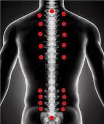 Bu noktalar daha çok kaslar, tendonlar ve kemikler olmaktadır. Fibromiyalji Ve Hacamat Tedavisi Geleneksel Ve Tamamlayici Alternatif Tip Getat Merkezi Dr Turansah Tumer