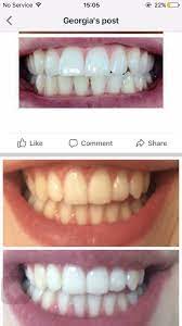 Maybe you would like to learn more about one of these? Isn T It Just Incredible How This Whitening Toothpaste Also Has The Ability To Remove Any Yellowness From Your Skin This Amazing Product Features 2 In 1 Whitening For Your Whole Face Now