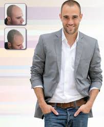 May 30, 2021 · eagles finish third in conference cup. Pin On Scalp Micropigmentation