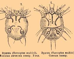 Image result for Sarcoptes scabiei