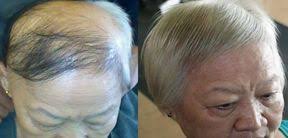 Dokulen Saclar Icin Evde Serum Hazirlayin Lost Hair Grow Hair Hair Loss Treatment