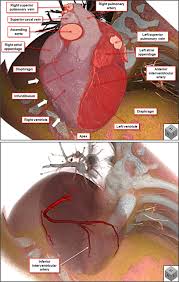 The homework help used by millions of students. What Is The Real Cardiac Anatomy Mori 2019 Clinical Anatomy Wiley Online Library