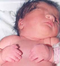 Image result for Malouetia mildbraedii