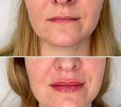 Булатова Ольга (@kosmetolog27_khv) • Instagram photos and videos