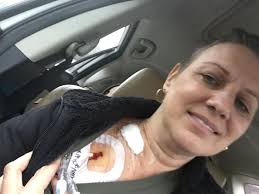 Successful kidney transplant experience