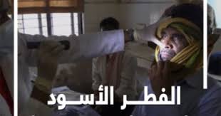 الصحة تكشف حقيقة انتشاره في مصر. Ucr4qhj8qqd7om