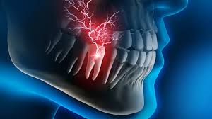 dentinal hypersensitivity ...