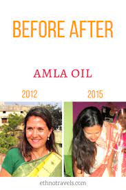 Emblica officinalis gaertn or phyllanthus emblica linn indian gooseberry or amla is an essential medicinal plant in the traditional system of medicine, the ayurveda. Amla Oil For Hair Growth And Thickness 2021 Review Ethno Travels Amla Oil Amla Oil Hair Growth Hair Growth Oil