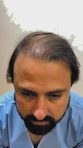 O participante Marcus Vinicius, do Big Brother Brasil 2024, é um dos  integrantes do grupo Pipoca. Natural de Belém do Pará, no Pará, Marcus tem  30 anos e trabalha como comissário de