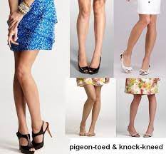 She was younger than me and i'd play with her sometimes. What Do Yout Think Of Pigeon Toed And Knock Kneed Girls Girlsaskguys