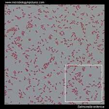 While some of the infections can be easily treated, some of. Salmonella Gram Stain And Cell Morphology Salmonella Micrograph Appearance Under The Microscope Salmonella Cell Morphology Salmonella Microscopic Picture Salmonella Enteritidis