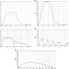 Uroflow Curve Patterns A Bell Shaped Normal B Tower