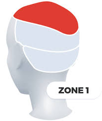 Image result for Hair Pull Test