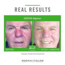 Lisa Stenger Martin's Rodan+Fields Biz