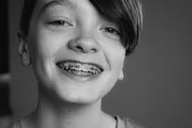 How to floss with braces without threader. How To Floss With Braces