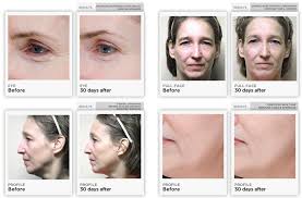 Before After Nuface Now At Modish Studios Nuface Skin Care Skin