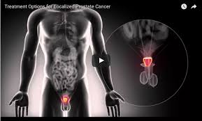 There are a number of different treatments doctors recommend. Low Risk Prostate Cancer Patients Should Consider Active Surveillance Over Surgery Radiation