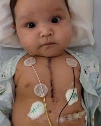 We posted a picture of an umpire with a catcher's mitt