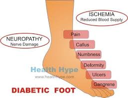 Untreated Diabetes Mellitus Consequences And Symptoms What Causes Diabetes Diabetes Mellitus Diabetes