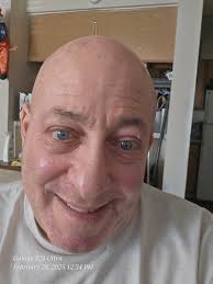 when are the vaccines available for 60 to 65 age group?????