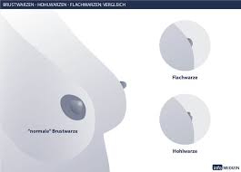 Es ist freitag abend und lena ist nach einer anstrengenden woche endlich in ihrer wohnung angekommen. Schlupfwarzen Was Hilft Gegen Hohlwarzen Info Medizin